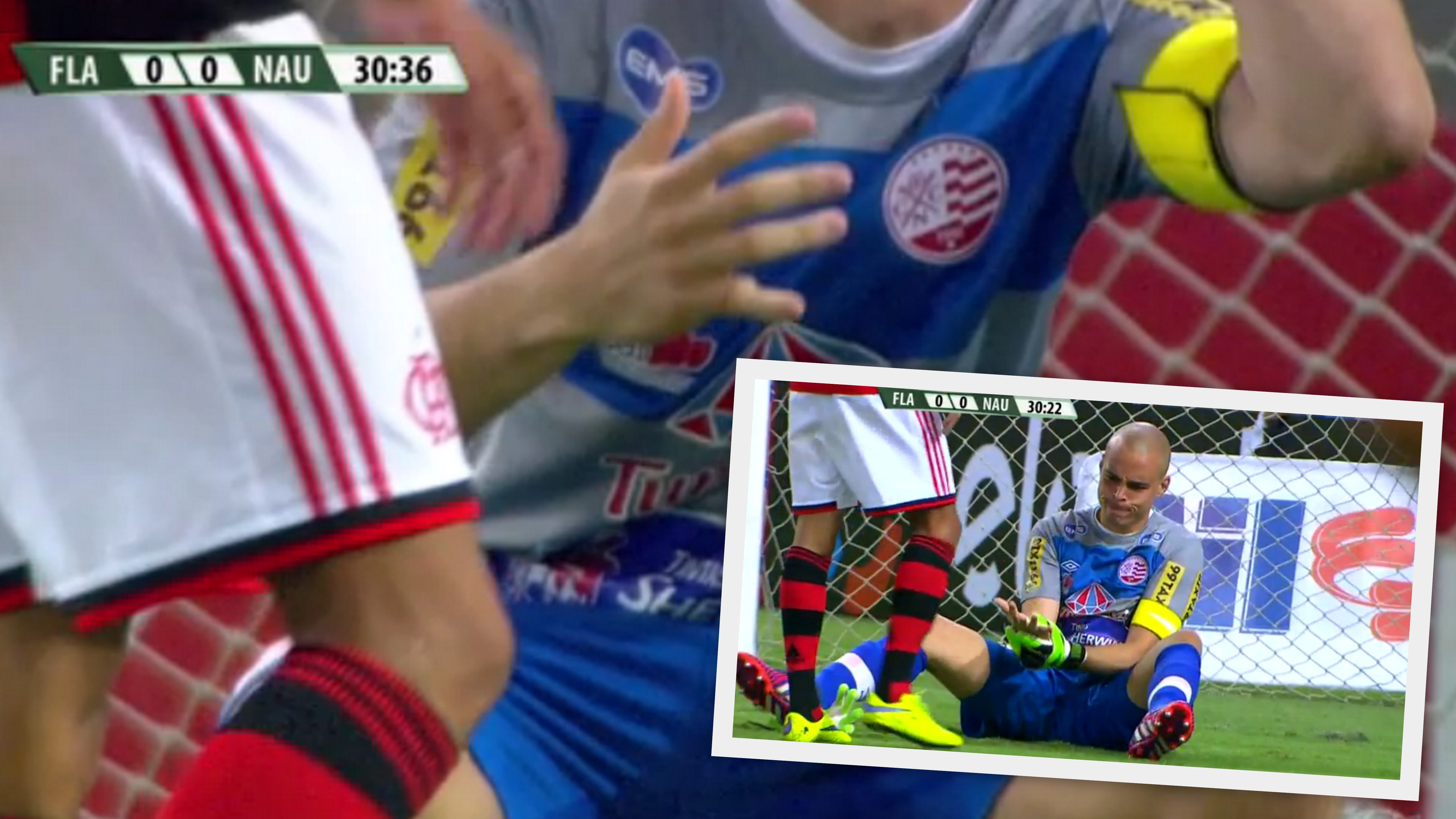 Brankár Julio Cesar_Brazília_zranenie